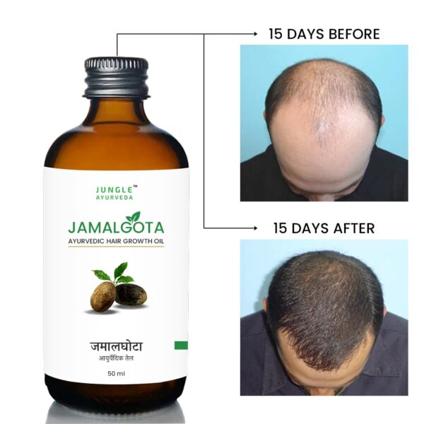 Jamalgota Ayurvedic Hair Oil 50 ml | Hair Fall Control and Hair Growth with Camphor & Coconut Oil - Nourishes Scalp & Stimulates Roots for Men & Women - Image 3