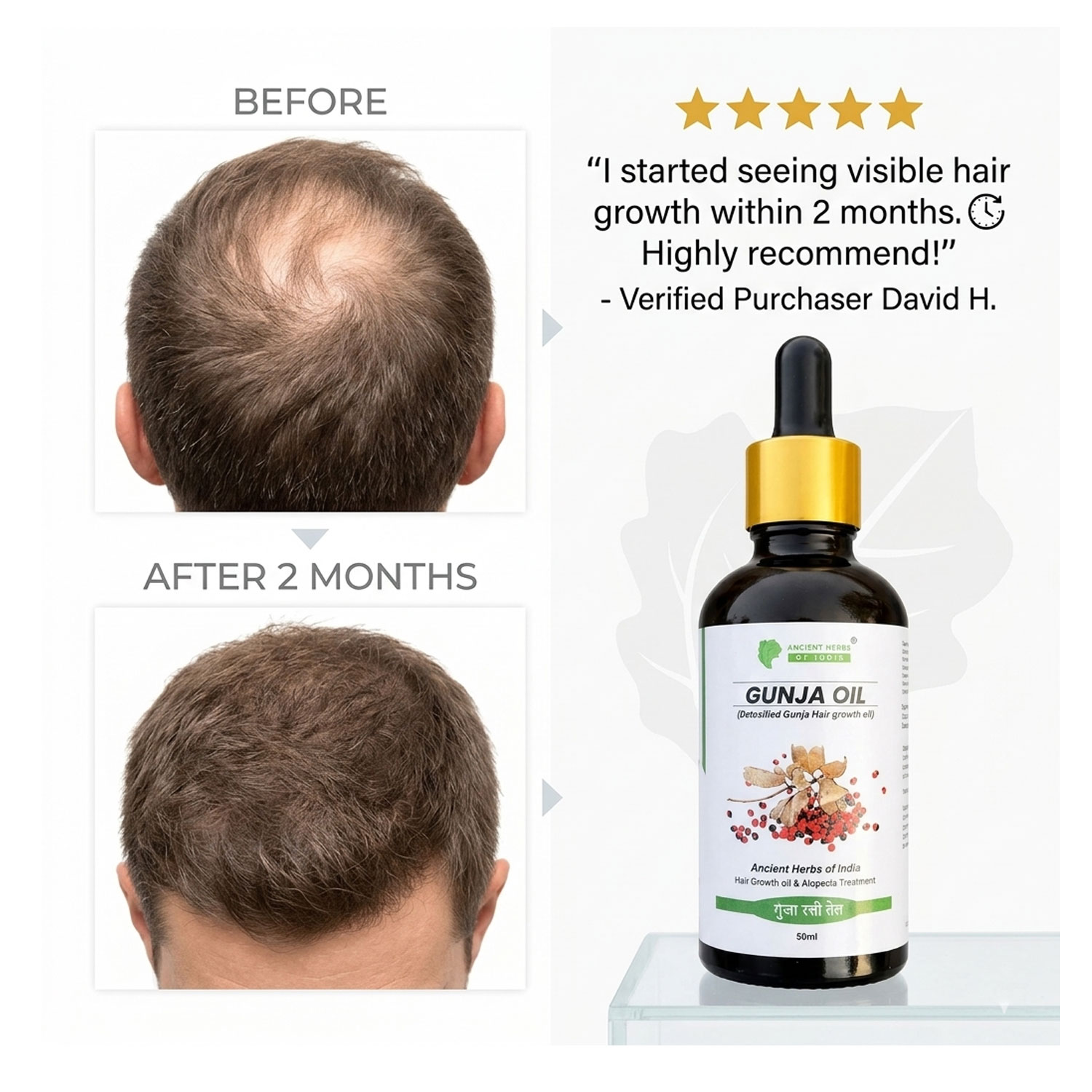 Gunja Ratti Hair Oil (Milk Detoxified) for Hair Regrowth & Alopecia Support – Activates Hair Follicles, Reduces Hair Fall, Natural Ayurvedic Scalp Treatment – 50ml