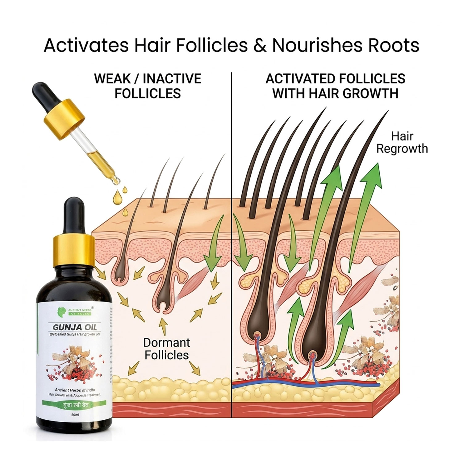 Gunja Ratti Hair Oil (Milk Detoxified) for Hair Regrowth & Alopecia Support – Activates Hair Follicles, Reduces Hair Fall, Natural Ayurvedic Scalp Treatment – 50ml