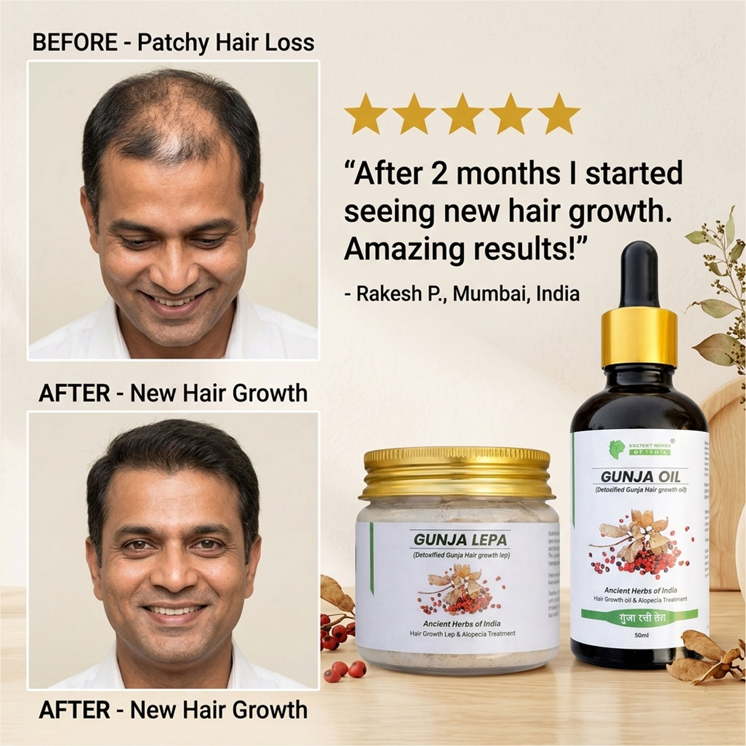 Gunja Hair Growth Combo (Oil + Powder Lep); Milk Detoxified Ayurvedic Formula; Supports Hair Regrowth & Alopecia Care; Activates Hair Follicles; Scalp Nourishment Treatment; 2-Step System