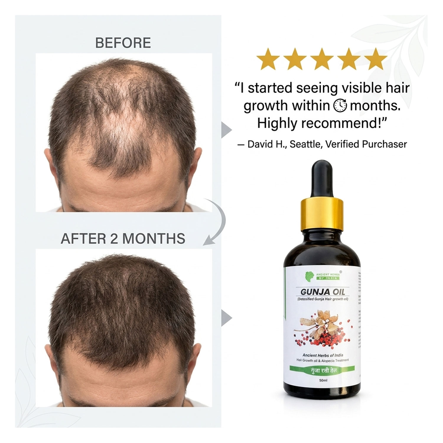 Gunja ratti hair oil for Hair and Scalp Treatment and Alopecia Treatment With Natural Extract of Arbus Precatorius