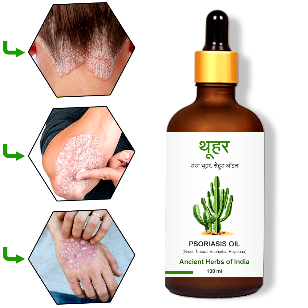 Danda Thuhar Psoriasis oil for scaly patches, Eczema and Psoriasis Treatment
