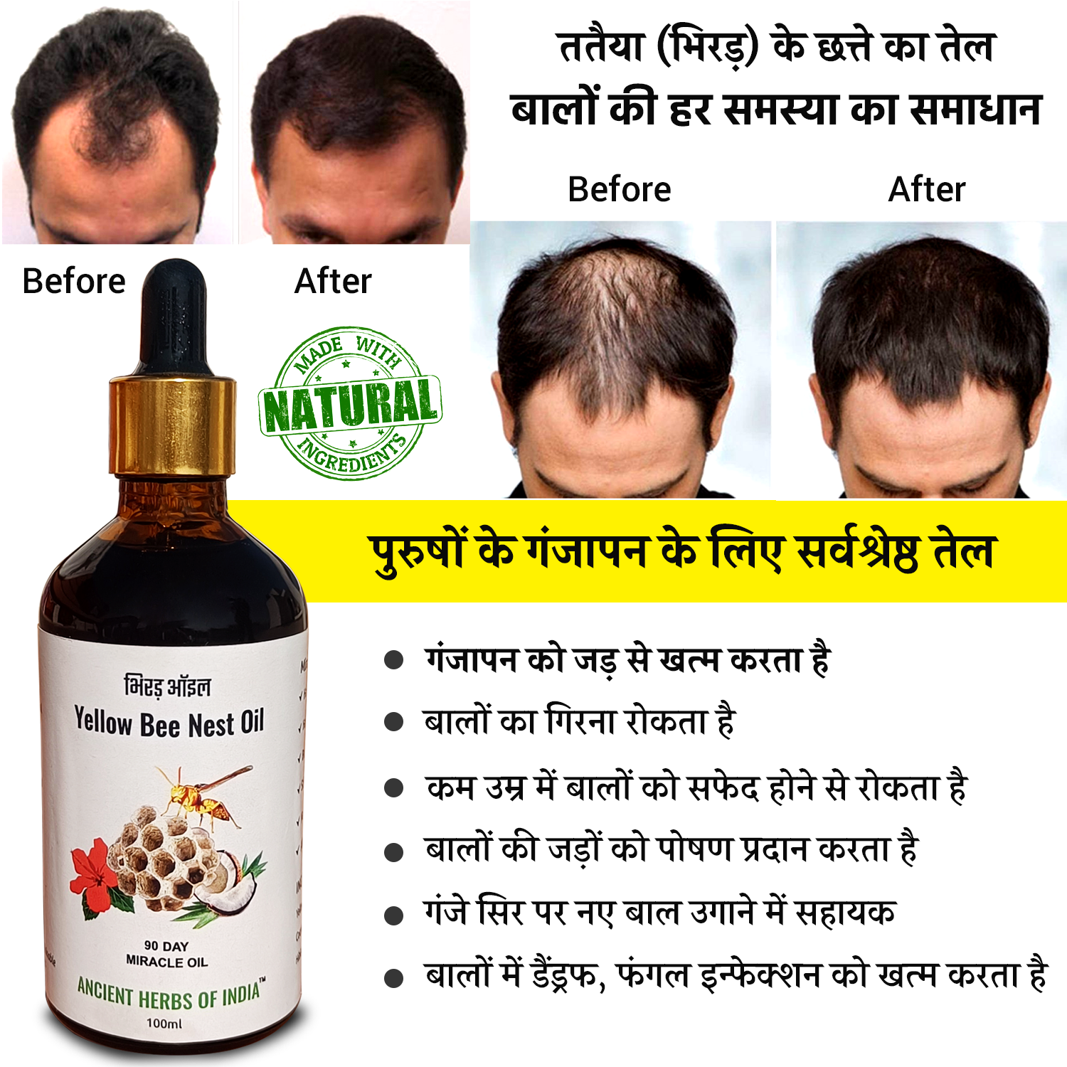 Yellow Bee Nest Hair Oil for Hair Growth & Hair Fall Control with Tataiya Chatta Oil